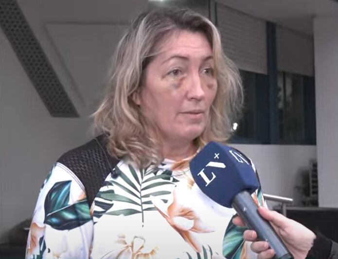 Así quedó el rostro de Silvia luego de ser golpeada por los delincuentes