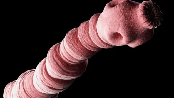 Echinococcus granulosus, también llamado gusano hidatídico, causa la enfermedad hidatídica