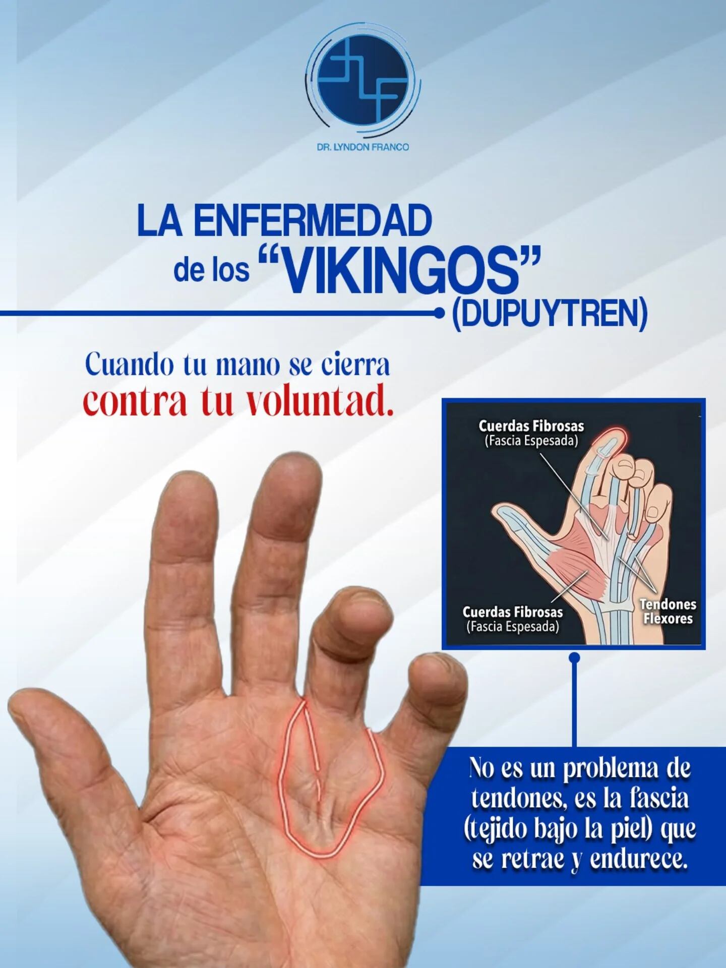 Se le llama