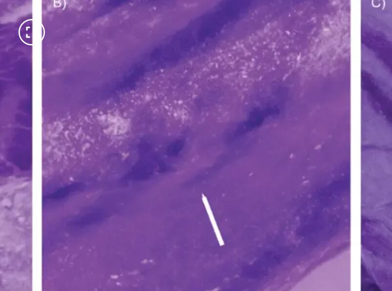 El detalle de los tatuajes (Foto: Gentileza Cambridge University Press en nombre de Antiquity Publications Ltd)