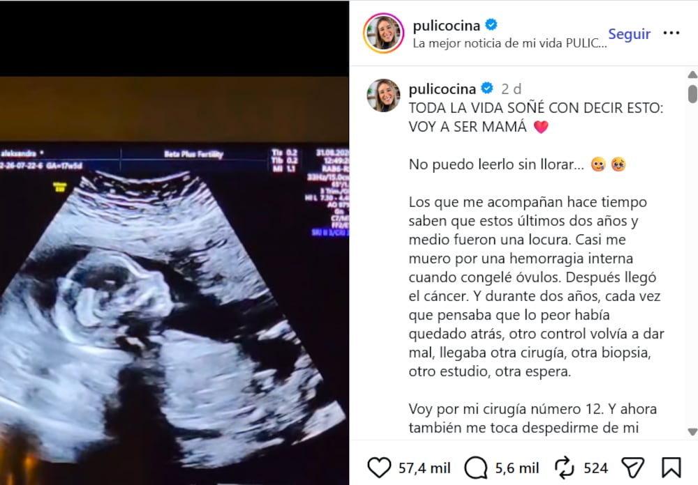El posteo de Puli anunciando que será mamá por subrogación de vientre