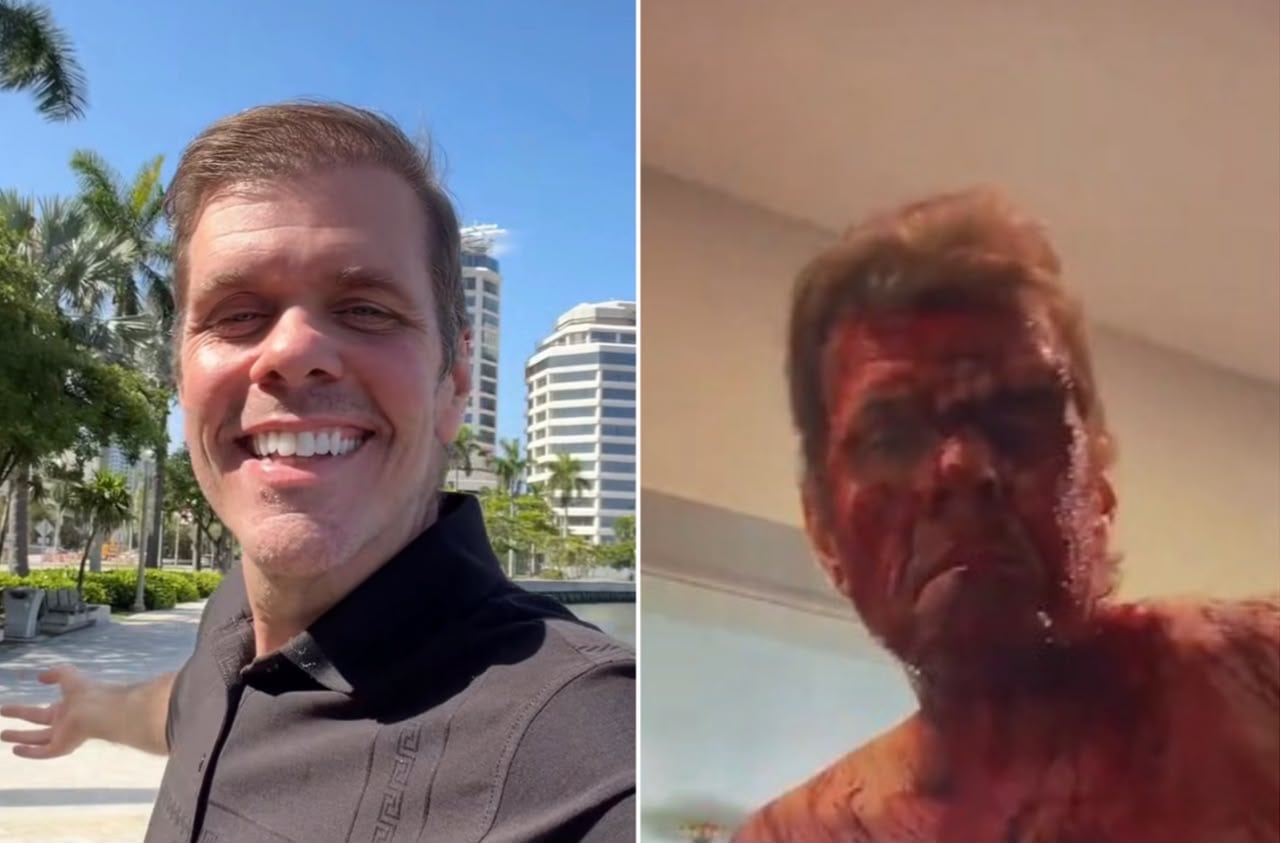 El famoso bloguero estadounidense Perez Hilton compartió un video en TikTok con aparentes cortes y sangre en su cuerpo