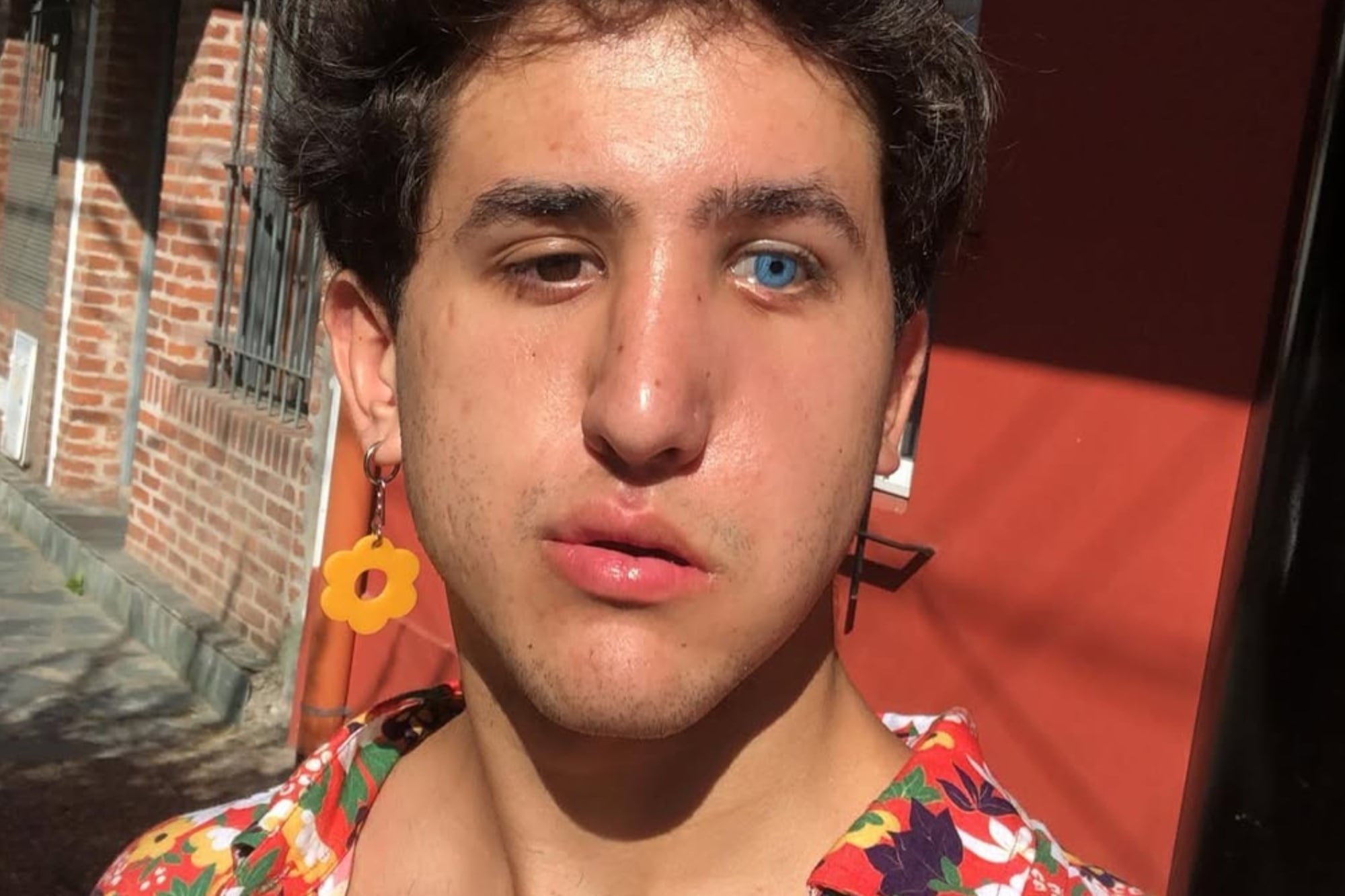 A los cinco años, Joaquín Acebo sufrió un severo accidente; se recuperó tras 21 días en coma y rehabilitación, hoy es uno de los actores que conmueven con su interpretación en El Eternauta (Foto: Instagram/@joacoacebo)