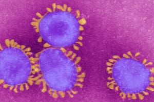 Descubren virus "gigantes" en el lugar más profundo del océano