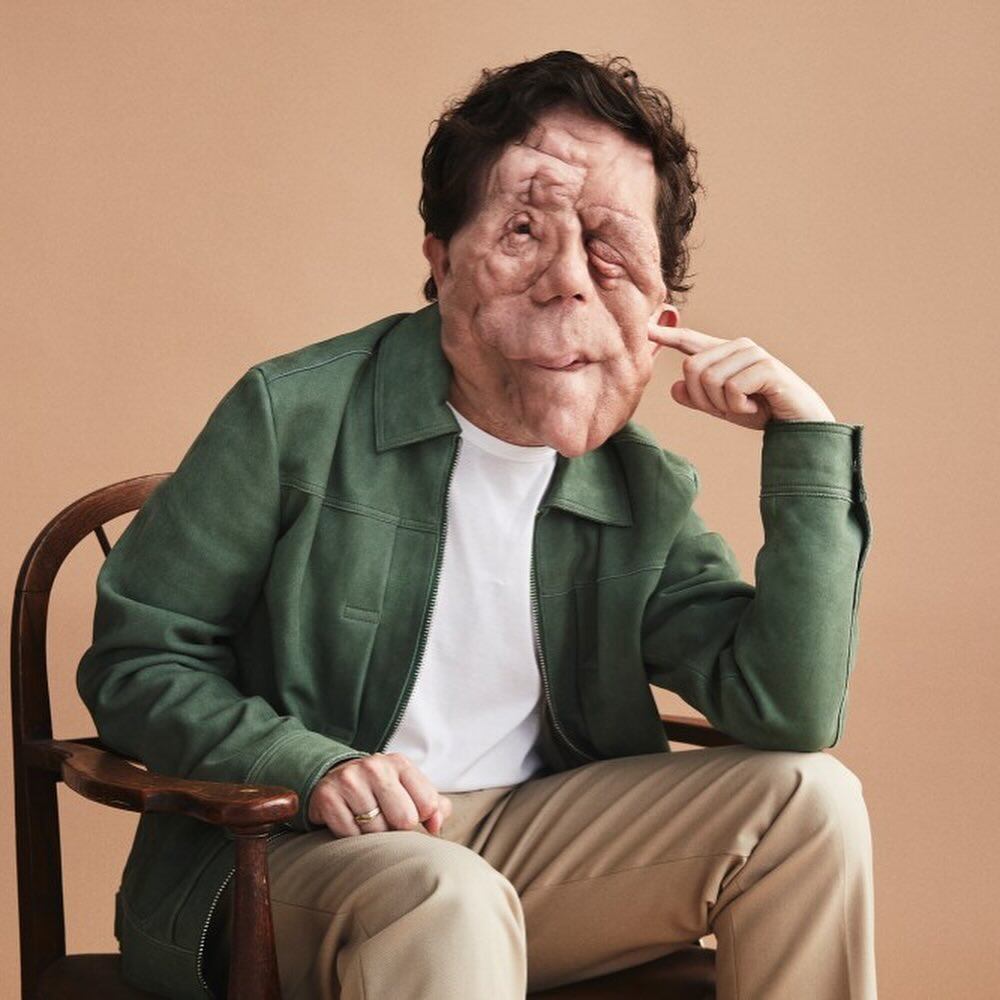 Adam Pearson es conocido por su papel en la película Under the Skin