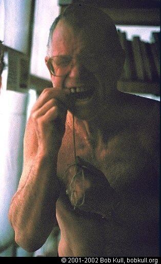 Durante su estancia en la Patagonia, Kull tuvo que extraerse un diente tras sufrir un absceso