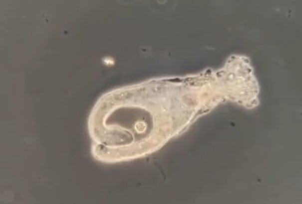 Qué es una ameba “come cerebros”: así actúa el naegleria fowleri, que tiene una mortalidad superior al 95%