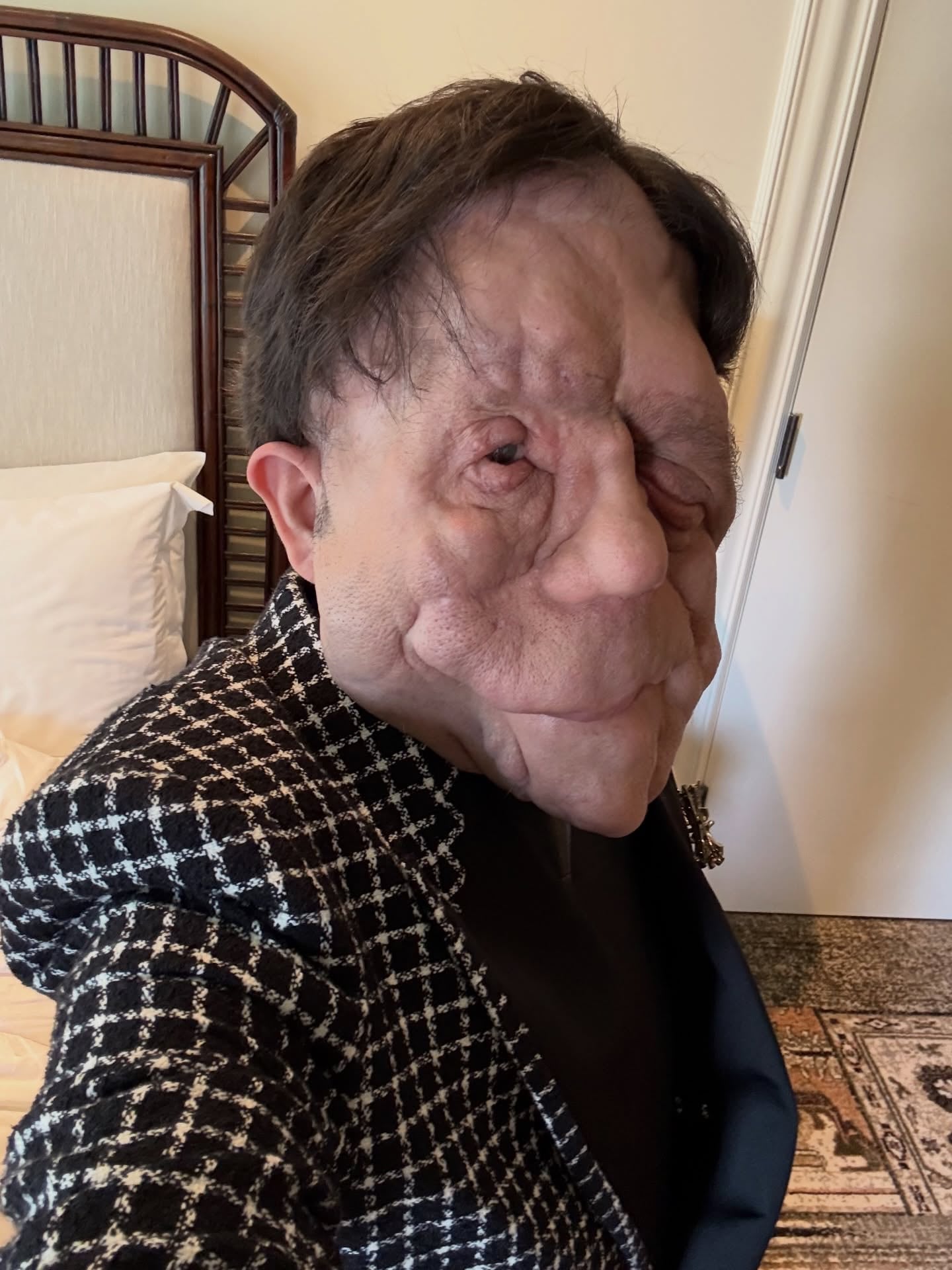 Adam Pearson compartió en sus redes sociales su emoción por asistir por primera vez a los Premios Oscar