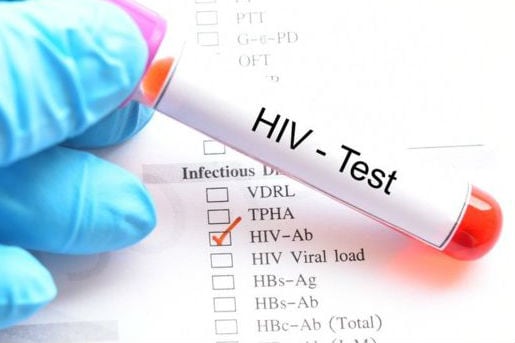 Recortes federales podrían provocar problemas de acceso para los medicamentos contra el VIH en Florida