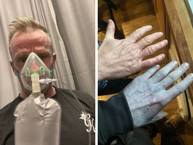 Se despertó azul, fue a la guardia médica de urgencia y el diagnóstico que recibió lo dejó atónito