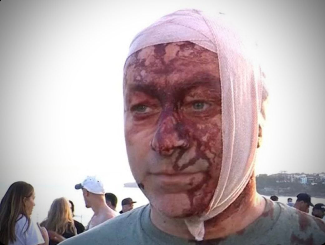 Una de las víctimas del atentado en Australia también sobrevivió al ataque de Hamas el 7 de octubre