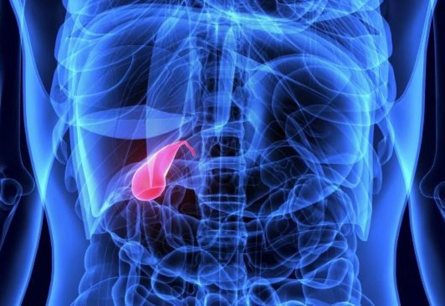 La vesícula biliar cumple la función de almacenar bilis y su extracción se indica ante cálculos, inflamación o cólicos recurrentes