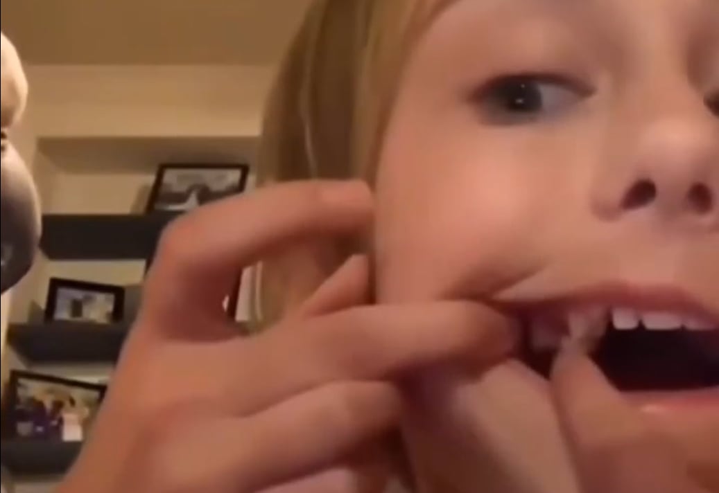 La pequeña se filma y muestra que su diente está flojo (Foto: Captura Instagram @elchamainforma)