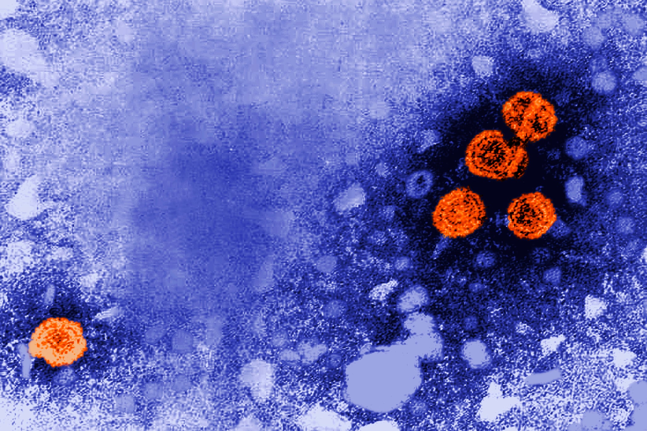 El sistema sanitario activó medidas preventivas tras detectar síntomas compatibles en viajeros procedentes de zonas afectadas