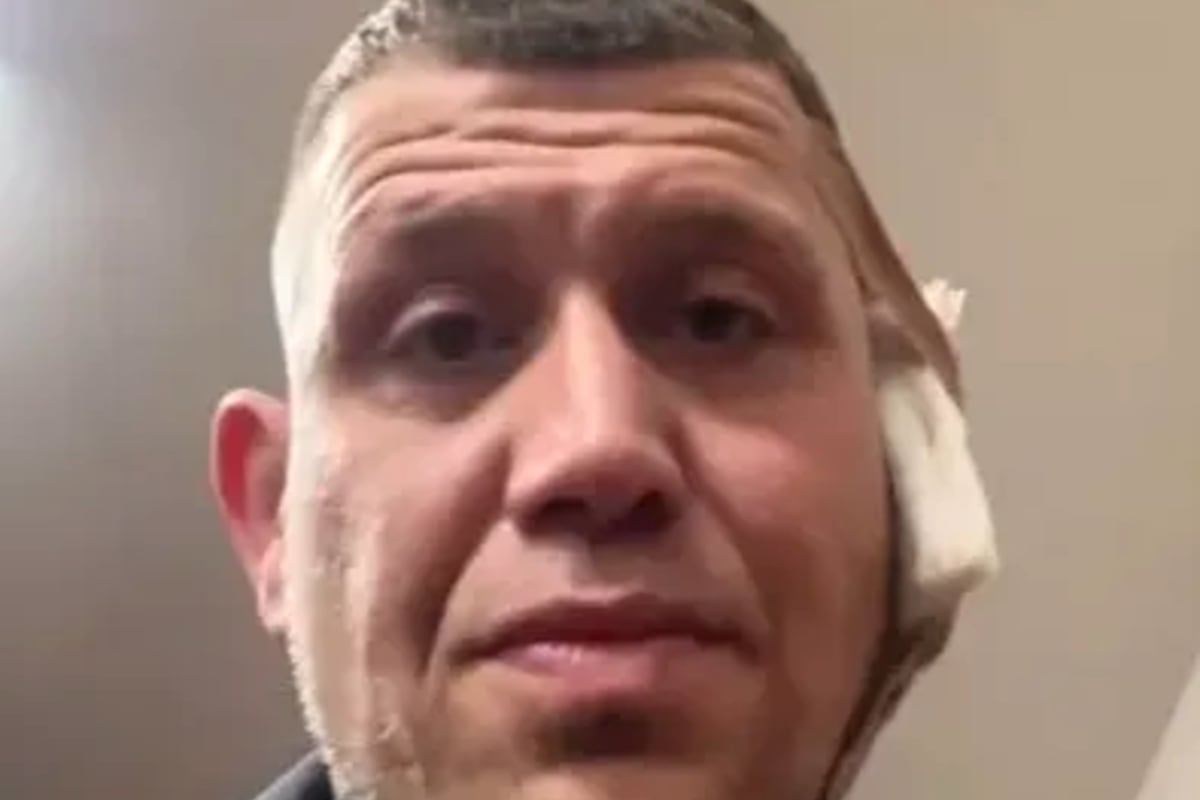 Vaclav Mikulasek compartió en redes sociales imágenes de la lesión y confirmó que debió recibir 28 puntos de sutura en la oreja afectada