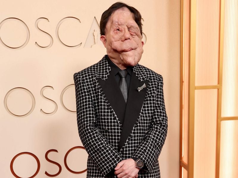 Adam Pearson asistió a la ceremonia de los Premios Oscar 2026