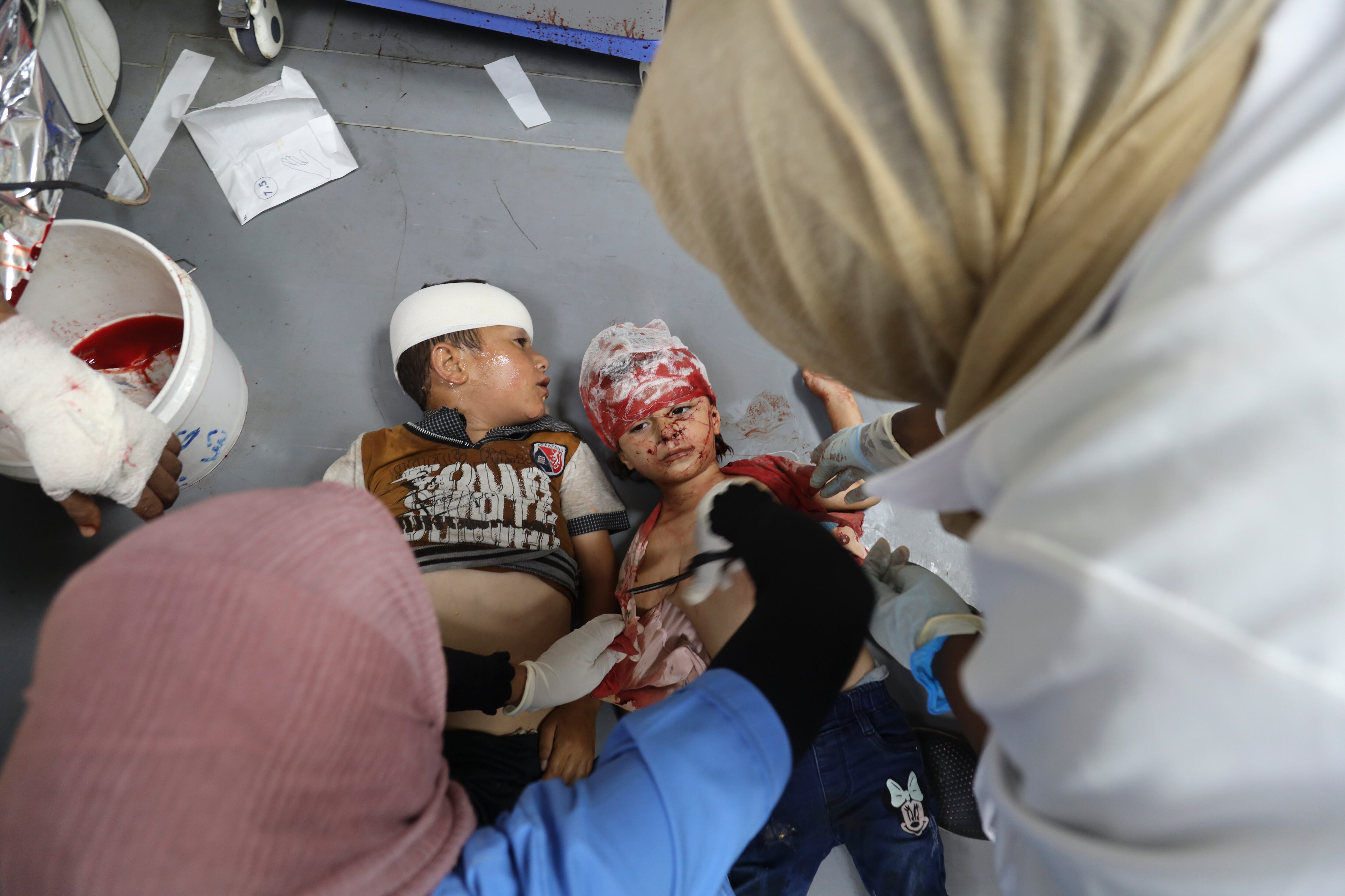 Niños palestinos heridos luego de un bombardeo israelí en la Franja de Gaza son atendidos en el Hospital de Al Aqsa, en Deir al Balah, el domingo 9 de junio de 2024. (AP Foto/Saher Alghorra)