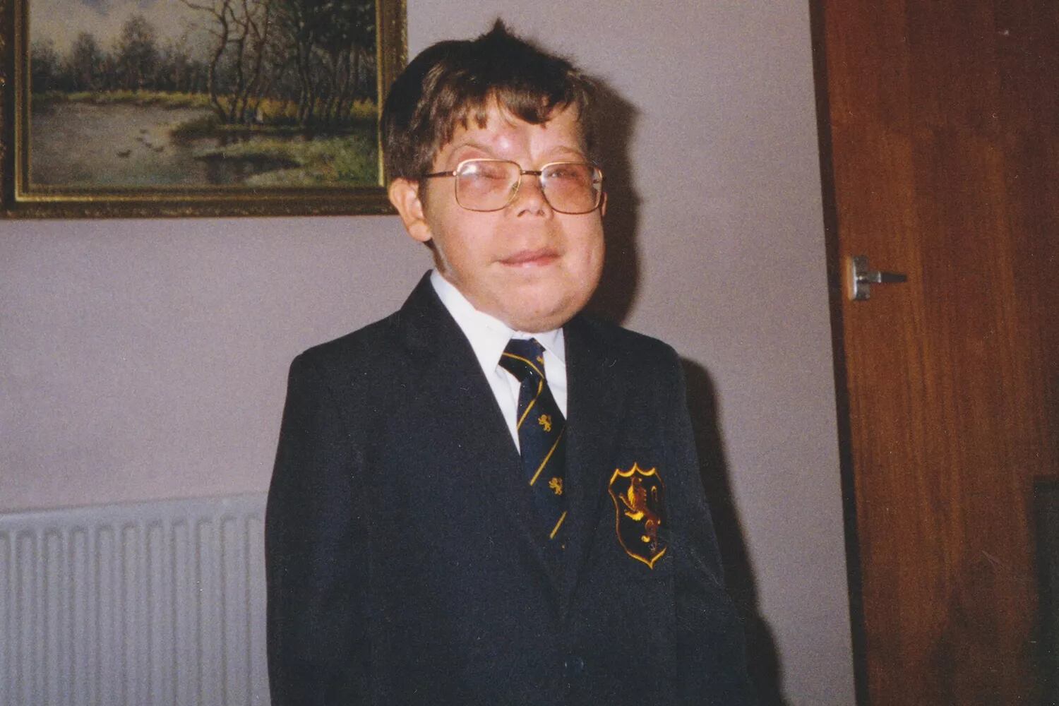 Adam Pearson durante su infancia