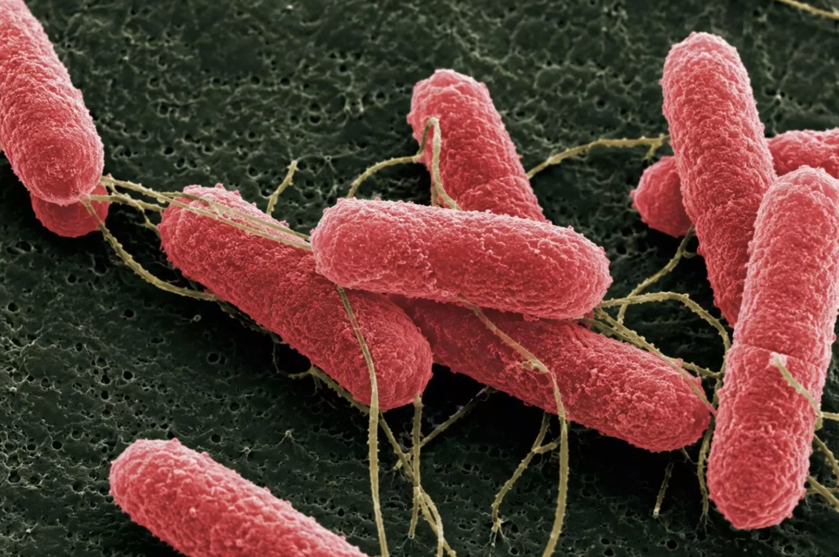 "Resultados alentadores": una molécula innovadora podría disminuir la carga de una bacteria que genera una enfermedad que afecta especialmente a niños