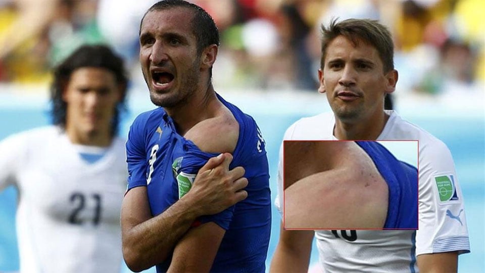Chiellini con la mordida de Luis Suárez, que aquel día no fue expulsado, pero luego fue sancionado por cuatro meses