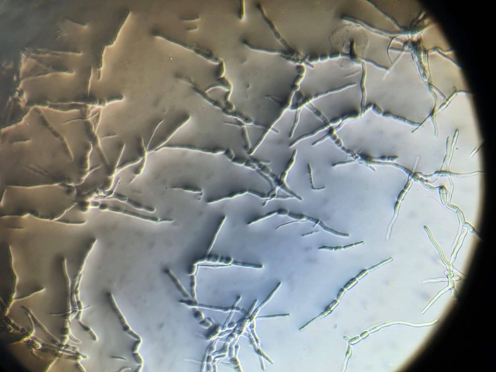 Lo confirmó la Fauba: se expanden las cepas resistentes del hongo que causa una enfermedad de la soja