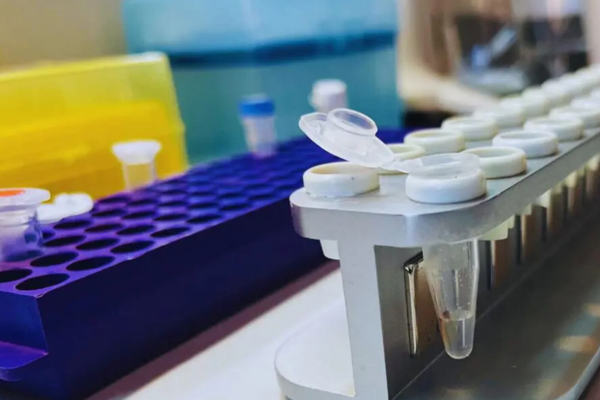 El genoma es la secuencia total de ADN que posee un organismo en particular