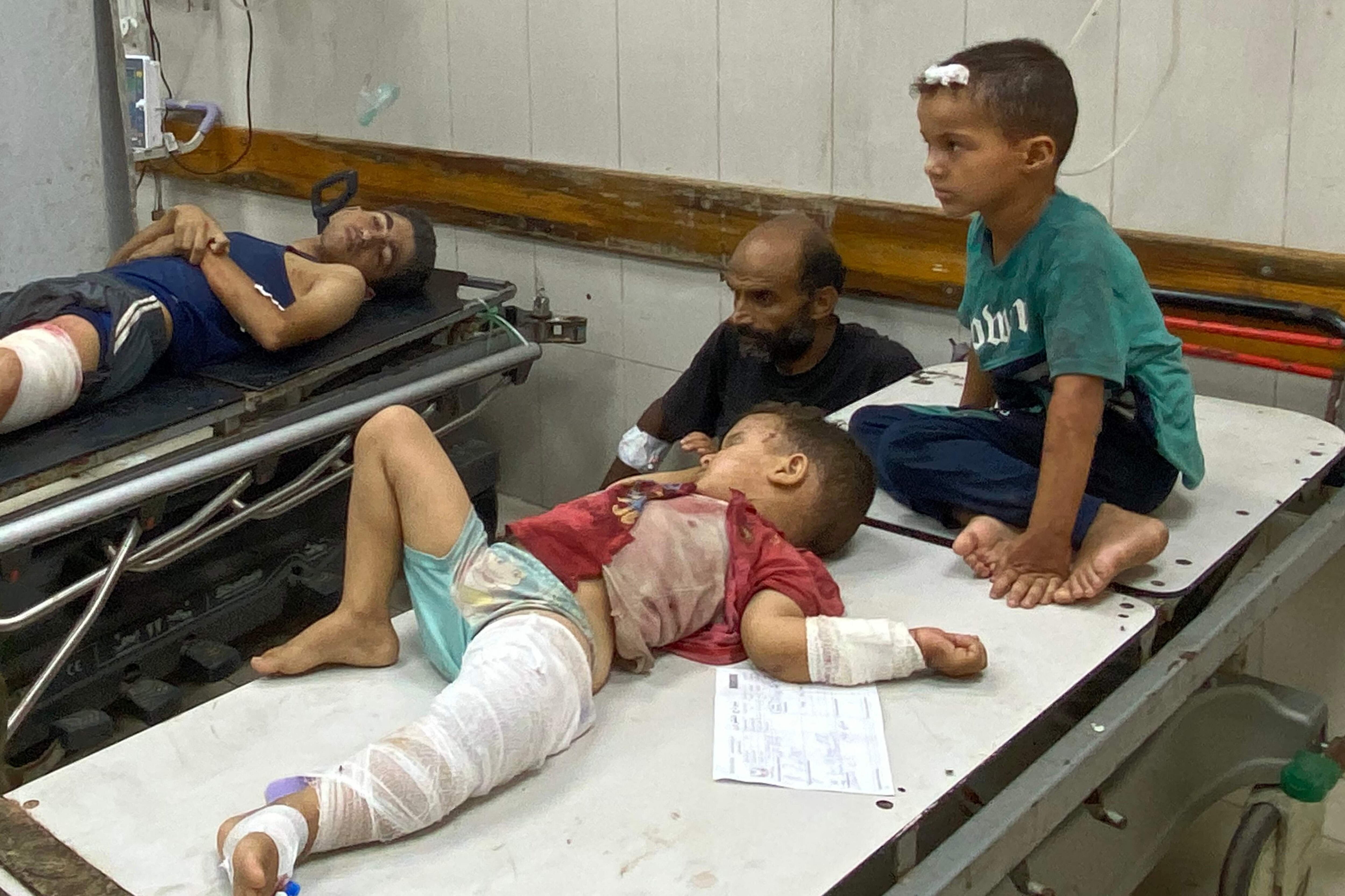 Niños heridos esperan recibir tratamiento en el Complejo Médico Nasser en Khan Younis, en el sur de la Franja de Gaza, el 28 de julio de 2025, luego del bombardeo israelí en el área de Mawasi