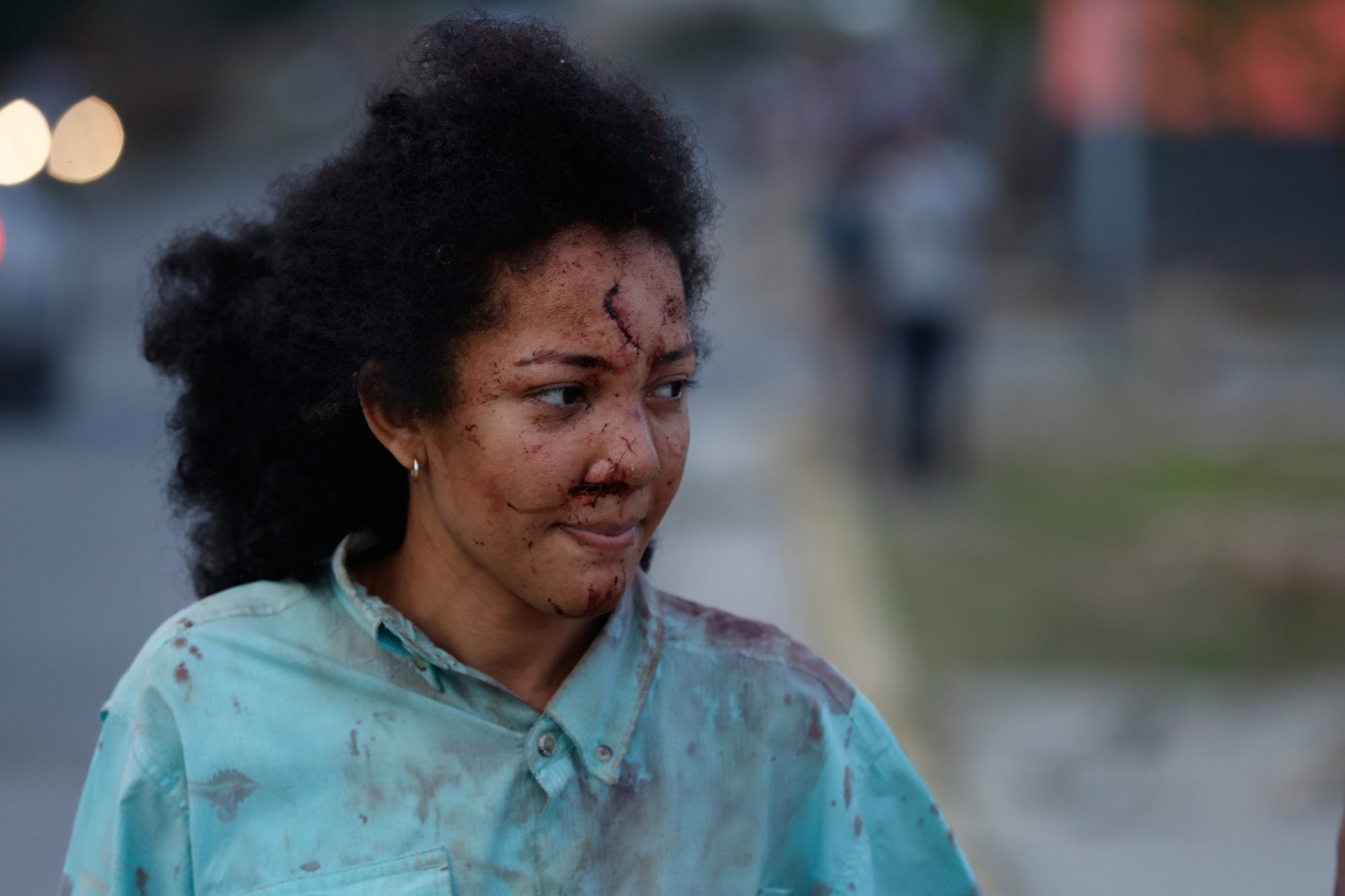 Una mujer herida camina en La Guaira, Venezuela, un día después de que un terremoto golpeara la zona