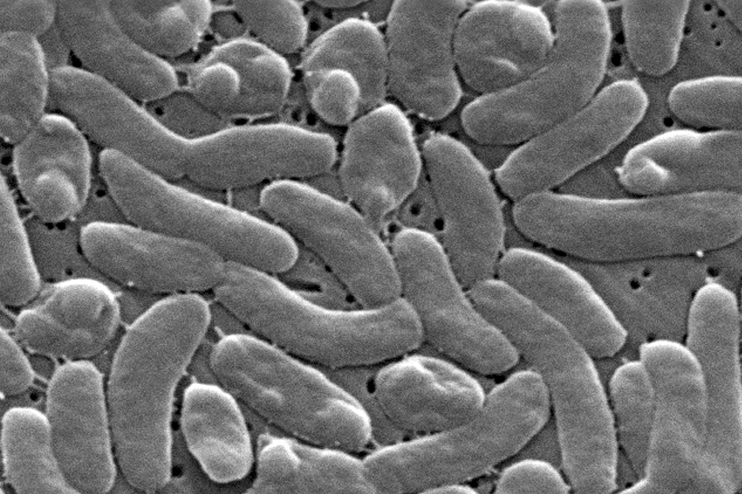 Alerta oficial en la costa: confirman presencia de bacteria “devoradora de carne” en Luisiana 6 ARCHIVO - Esta imagen del microscopio electrónico de 2005 proporcionada por los Centros para el Control y la Prevención de Enfermedades de EEUU (CDC) muestra bacterias Vibrio vulnificus. (Foto, Janice Haney Carr/CDC vía AP, Archivo)