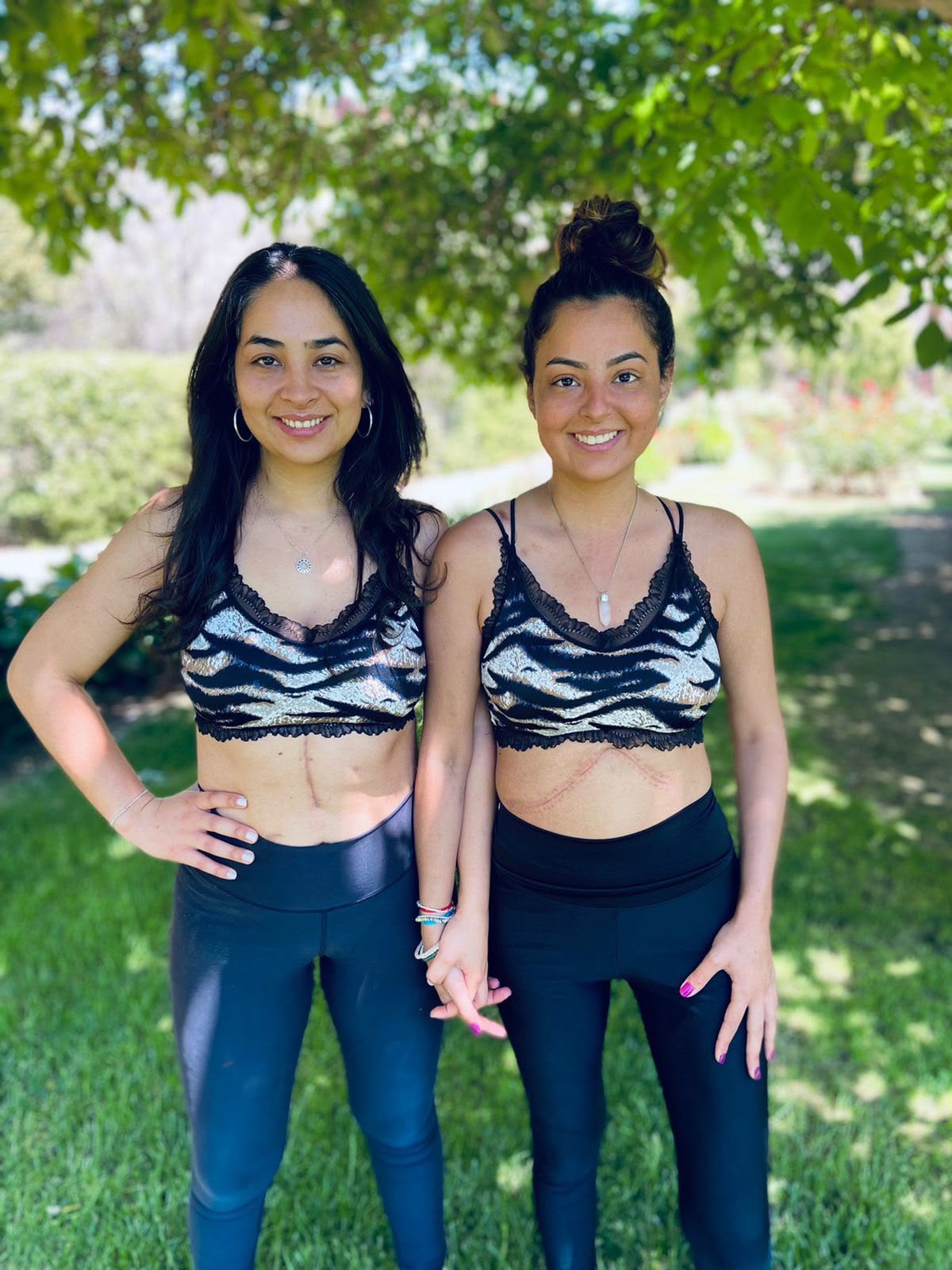 Isabella junto a su hermana mayor, Camila, quien resultó ser 100% compatible para convertirse en donante viva (Foto: Gentileza Isabella)
