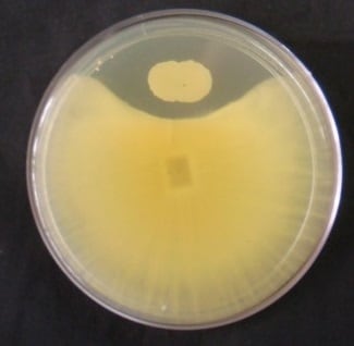 Además de la biotransformación, existen otros métodos que se basan en el uso de microorganismos para abordar la contaminación con micotoxinas de distintas familias en la industria alimentaria; por ejemplo, la bioadsorción