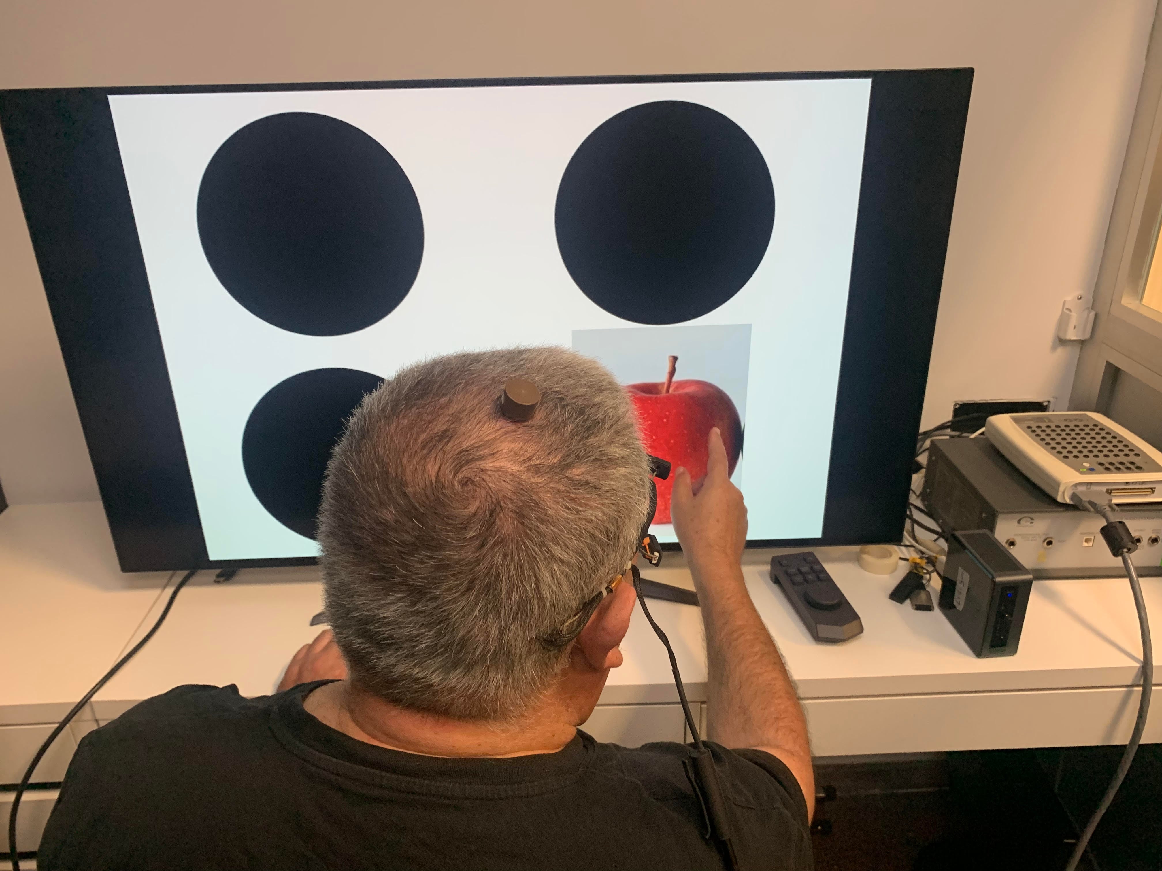 Un hombre con ceguera total causada por un daño irreversible en el nervio óptico ha recuperado parcialmente la visión natural tras participar en un ensayo clínico de estimulación eléctrica