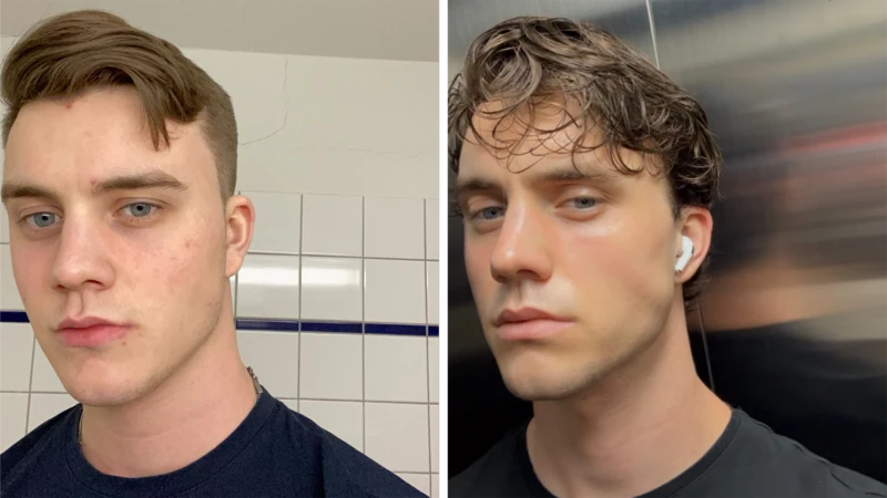 Leander dice que está intentando mejorar su aspecto para aumentar su autoestima