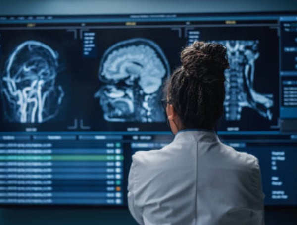 El origen de las demencias continúa siendo desconocido