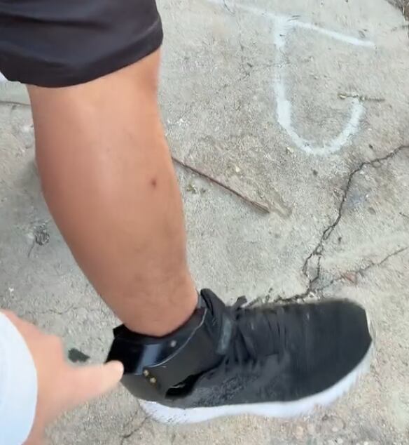 A este inmigrante le pusieron un grillete en el tobillo como una alternativa a la detención migratoria