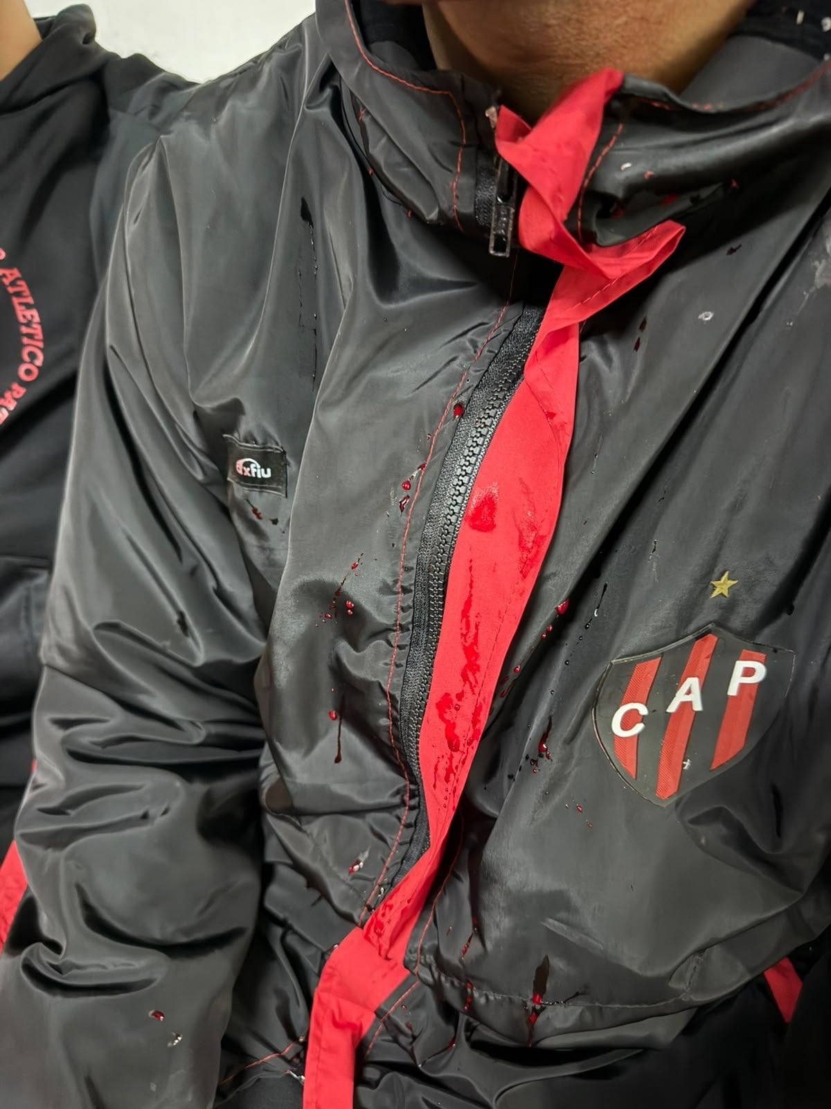 Manchas de sangre sobre la ropa de un jugador de Patronato