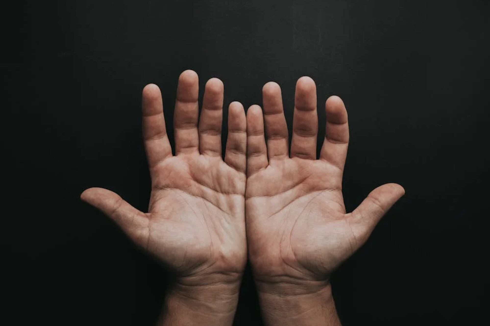 Por qué aparecen las manchas oscuras en las manos y cuáles son los cuidados que hay que tener para evitarlas
