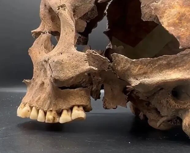 La arqueóloga croata Nataša Šarkić explicó los signos de violencia que recibió el cráneo del hombre cuando estaba con vida. Esto se debía a su trabajo como Caballero Templario