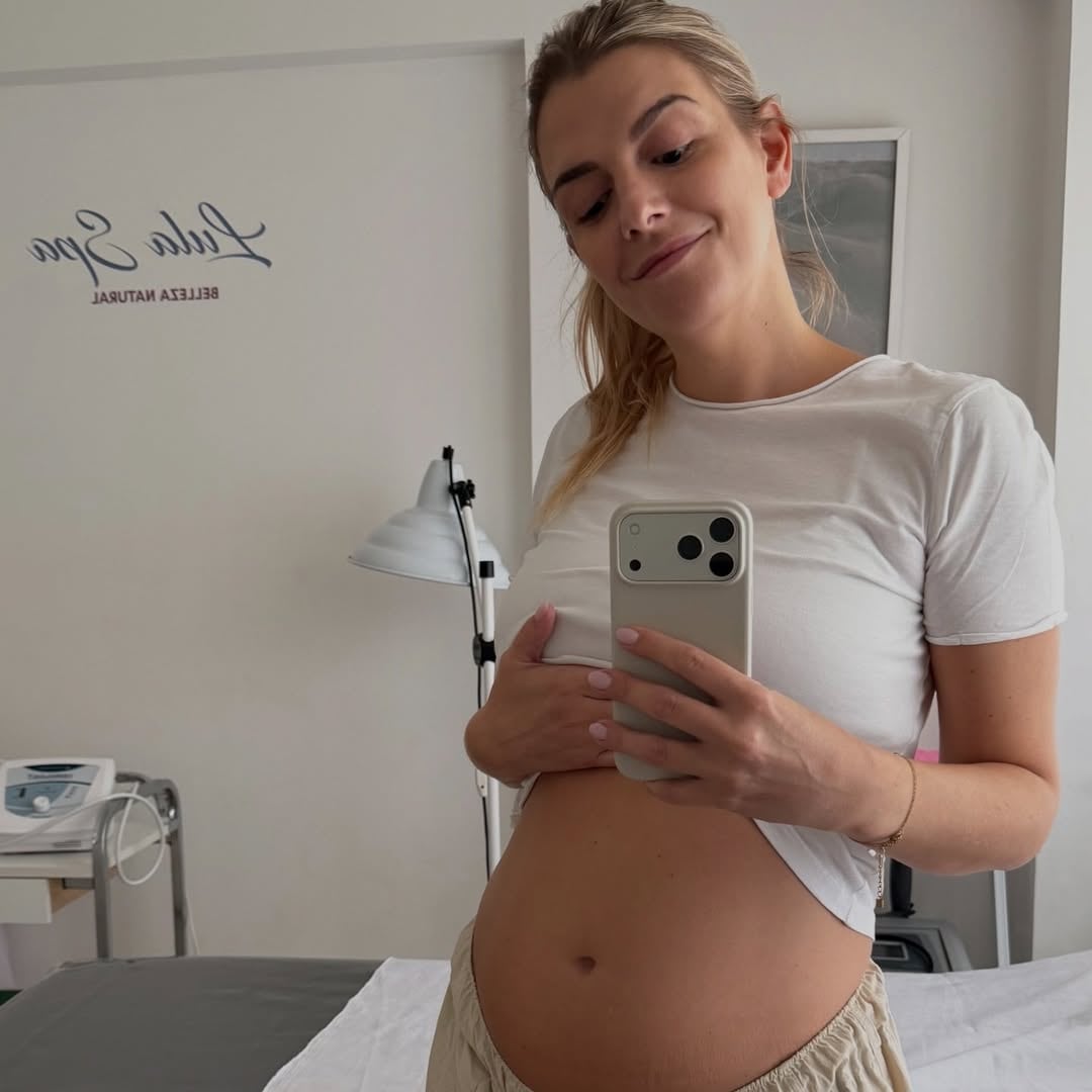 Sofía Aldrey, la exnovia de Federico Bal, anunció su embarazo (Foto: Instagram @sofialdrey)