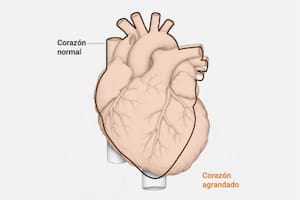 Así de lastimado terminó el cuerpo de Diego Armando Maradona