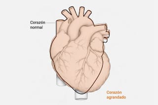 Así de lastimado terminó el cuerpo de Diego Armando Maradona