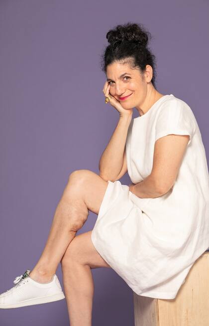 A Carolina Castagnola (47) una estufa le quemó su pierna.