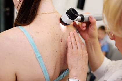 A la inspección ocular clásica hecha por un especialista se suman herramientas digitales para analizar la piel y determina si una mancha es inofensiva o requiere de una investigación más profunda