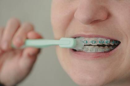 A las personas con aparatos ortodónticos se les recomienda cepillarse los dientes después de cada comida