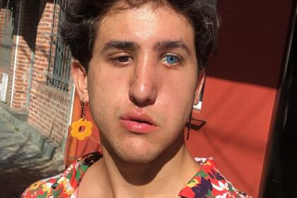 A los cinco años, Joaquín Acebo sufrió un severo accidente; se recuperó tras 21 días en coma y rehabilitación, hoy es uno de los actores que conmueven con su interpretación en El Eternauta (Foto: Instagram/@joacoacebo)