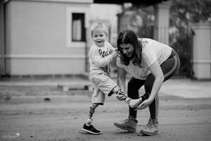 A los dos años Ian ya caminaba solo
y en la actualidad cuenta con dos prótesis: unas para caminar y otras para correr.