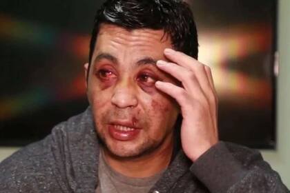 A mediados de 2020, Daniel Porro fue golpeado salvajemente por un grupo de vecinos que además prendieron fuego su casa y robaron su automóvil