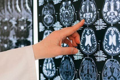 A medida que las personas envejecen, el cerebro puede experimentar una disminución en su capacidad para realizar tareas cognitivas