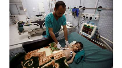 Un bebe es controlado por el enfermero en el hospital de Sanaa