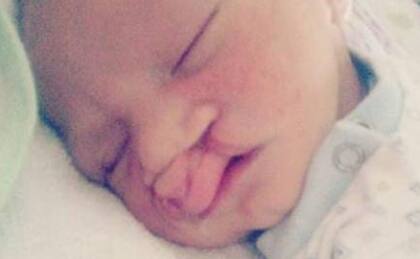 A raíz de su enfermedad a Tomás, durante su primer año de vida, le realizaron una corrección de base y a los dos años y medio fue sometido nuevamente a una operación para la corrección de su paladar.